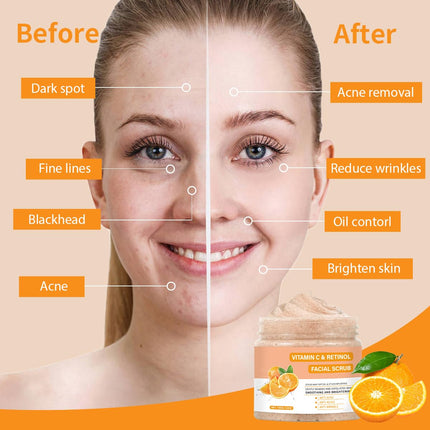 Facial Exfoliating Scrub with Retinol Deep Clean Face Wash Men Women Skincare