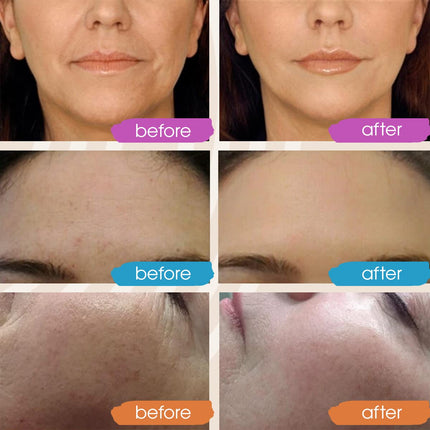 Retinol & Vitamin C Face Serum Set – Hyaluronic Acid, Glow & Hydration, 3x1oz