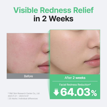 Centella Unscented Serum 2oz, Soothing Korean Skincare for Sensitive Skin, Vegan