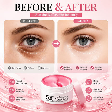 80PCS Collagen Under Eye Patches with Niacinamide, Eye Masks for Dark Circles & Puffiness