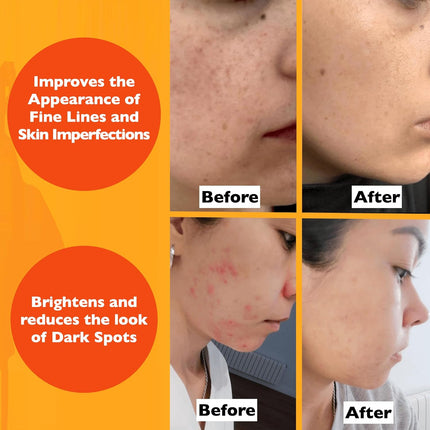 Vitamin C Face Serum – Anti-Aging with Hyaluronic Acid & Vitamin E