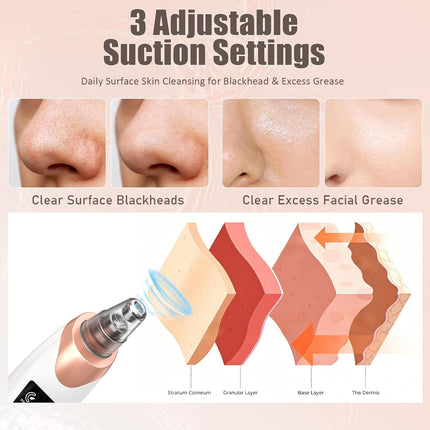 2026 Blackhead Remover Vacuum with Adjustable Suction & USB Charging