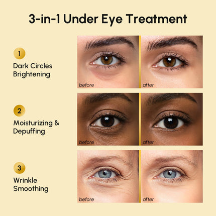 24K Gold Under Eye Gels – Dark Circles & Puffiness, Collagen & Hyaluronic