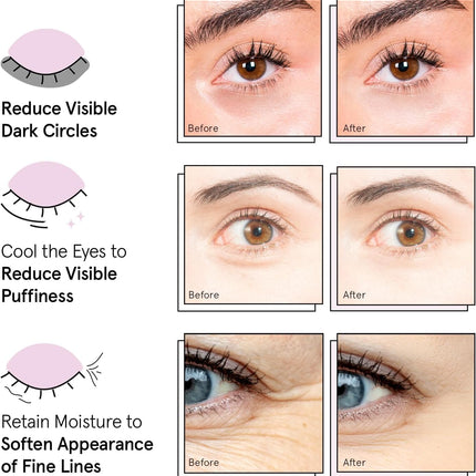 Award Winning Under Eye Mask Gel Patches for Dark Circles & Puffy Eyes