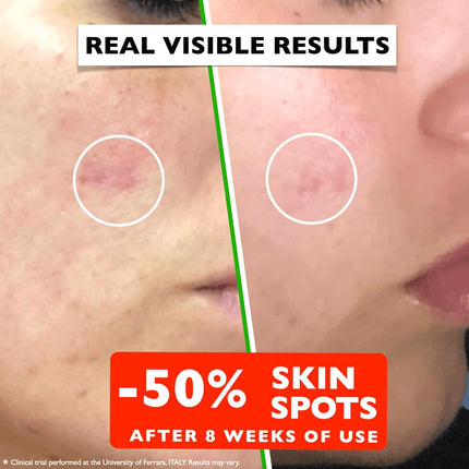 Vitamin C Face Serum – Anti-Aging with Hyaluronic Acid & Vitamin E