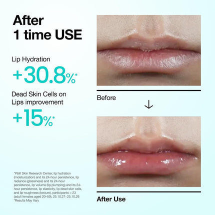 PDRN Lip Serum 0.33oz, Salmon DNA Hyaluronic Acid Collagen Hydrating Lip Care