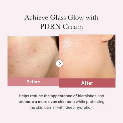 Salmon DNA PDRN Pink Hyaluronic Cream 1.69oz, Hydrating Moisturizer Pores & Blemishes