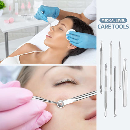 Blackhead Remover Comedone Extractor Acne Removal Tool Kit Stainless Steel
