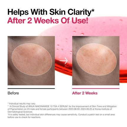 Glow Back Serum – Niacinamide, Tranexamic & Hyaluronic Acid for Skin