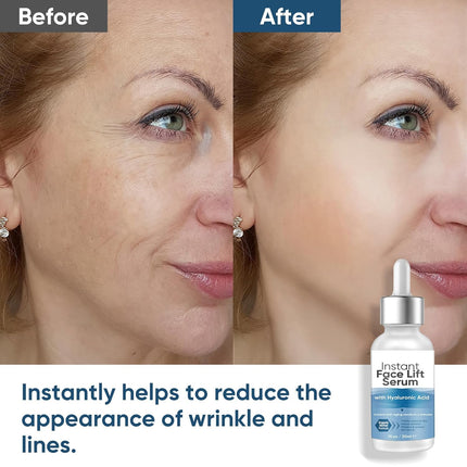 Instant Face Lift Serum – 2-Minute Skin Tightening with Hyaluronic Acid