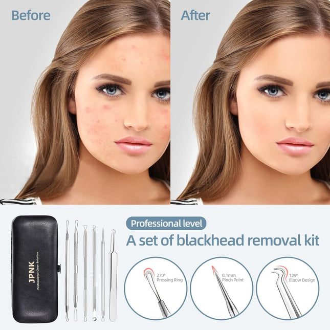 Blackhead Remover Comedone Extractor Acne Removal Tool Kit Stainless Steel