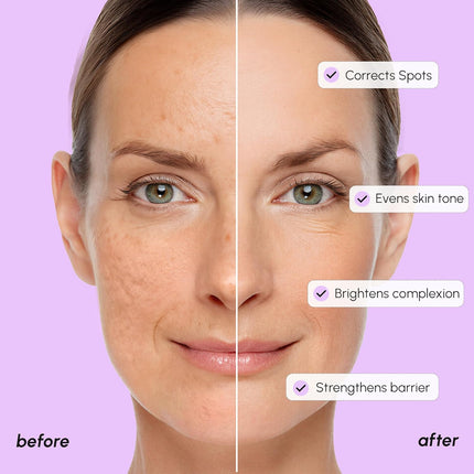 Brightening Face & Body Serum – Tranexamic Acid for Age Spot Removal