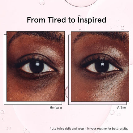Under Eye Brightener with Cooling Rollerball – Ceramide & Caffeine Serum for Puffy Eyes (15ml)