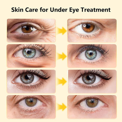 30 Pairs 24K Gold Under Eye Patches, Eye Masks for Puffiness & Dark Circles, Skincare