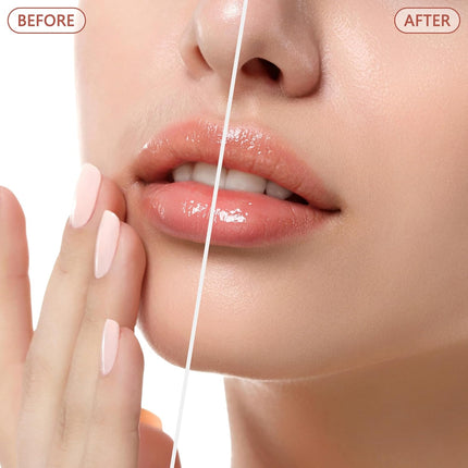 Facial Hair Remover for Women – Painless Electric Face Shaver, Rose Gold