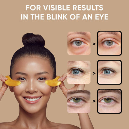 Under Eye Patches 20 Pairs – Reduce Puffiness & Dark Circles, Collagen Mask
