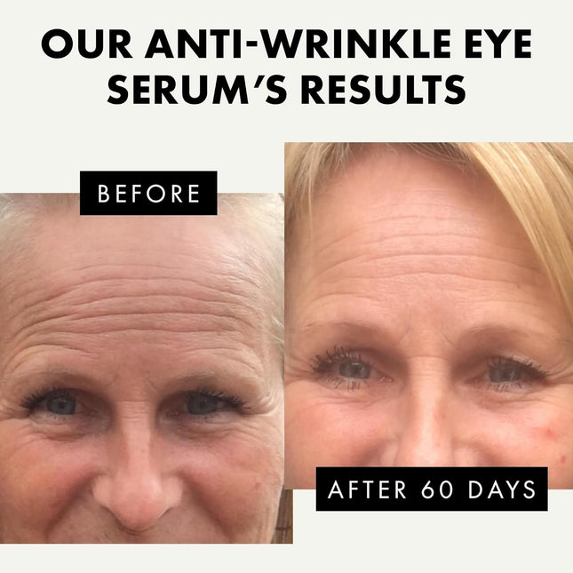 Hyaluronic Acid Eye Serum 0.5oz – Hydrate, Reduce Wrinkles & Fine Lines