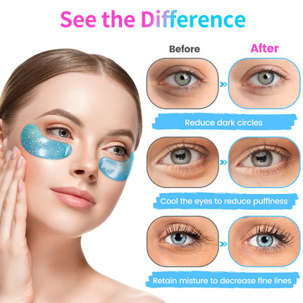 Under Eye Patches 24 Pairs – Reduce Wrinkles, Dark Circles & Puffiness