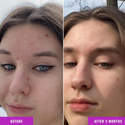 Niacinamide Serum 10% – Targets Blemishes, Brightens & Hydrates Skin