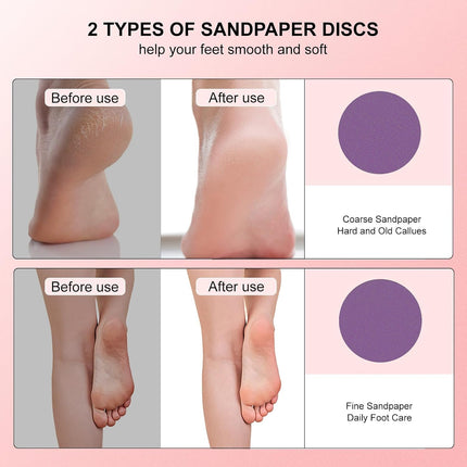 3-Speed Waterproof Electric Foot Callus Remover, Rechargeable Foot File with Sand Discs