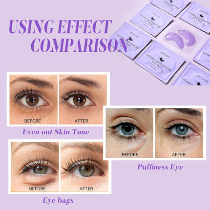 30 Pairs Vitamin C Under Eye Patches for Dark Circles & Puffiness Treatment