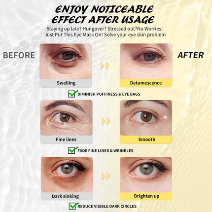 24 Pairs Retinol Under Eye Patches for Dark Circles Puffiness & Wrinkles