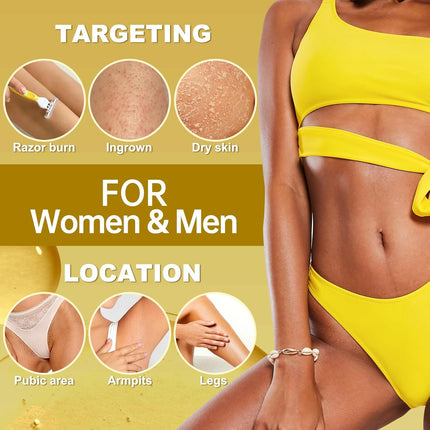 Ingrown Hair Treatment – Razor Bump & Burn Remover for Men & Women, 40ml