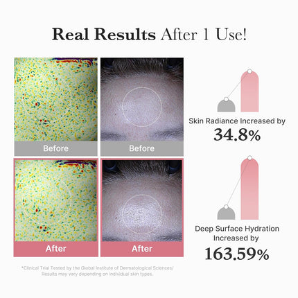 Salmon DNA PDRN Pink Vita Sheet Mask 10EA – Korean Glass Skin Mask