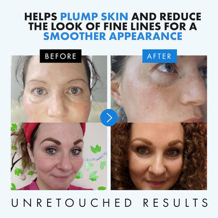 Hyaluronic Acid Serum 2.5% + B5 3% – Hydrating & Plumping Face Serum