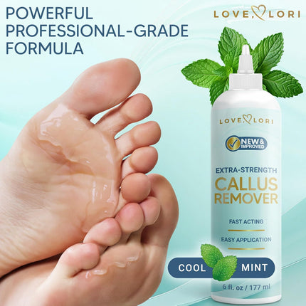 Extra Strength Callus Remover Gel, 6oz – Foot Scrubber & Pedicure Tools for Smooth Feet