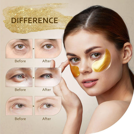 24K Gold Eye Mask – Reduces Wrinkles, Dark Circles & Puffiness, 30 Pairs