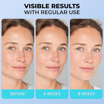 Face Moisturizer for Aging Skin – Retinol, Collagen & Hyaluronic Acid