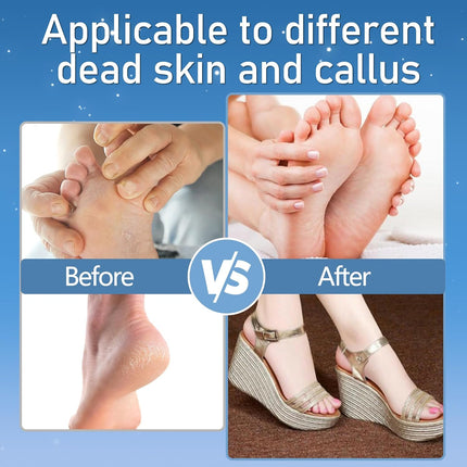 Electric Foot Callus Remover – Waterproof, 2 Speeds, 3 Rollers, Rechargeable