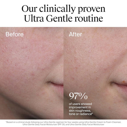 Hydrating Daily Face Moisturizer with Vitamin B3, Pro-Vitamin B5 & Vitamin E